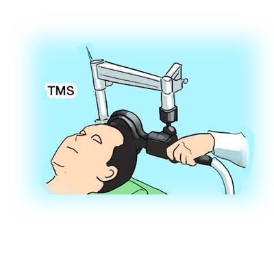 TMS