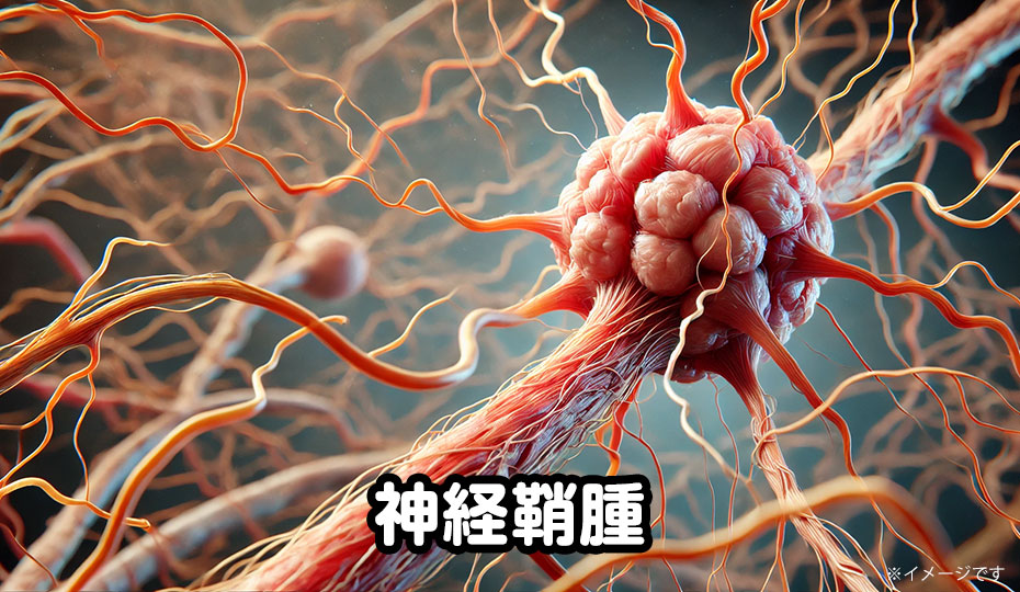 神経鞘腫に対する再生医療の研究と成果