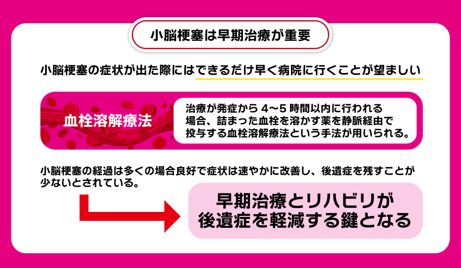 小脳梗塞は早期治療が重要