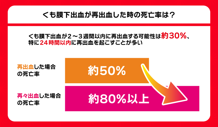 くも膜下出血が再出血してしまった場合の死亡率は？