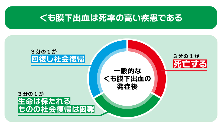 くも膜下出血は致死率の高い疾患